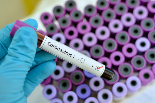  Coronavirus in Sicilia, pronta la circolare dell'assessorato della Salute: ecco i punti cardine